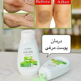 نمک بدن آلوئه ورا سادور رفع تیرگی و از بین برنده جای جوش اصل وارداتی