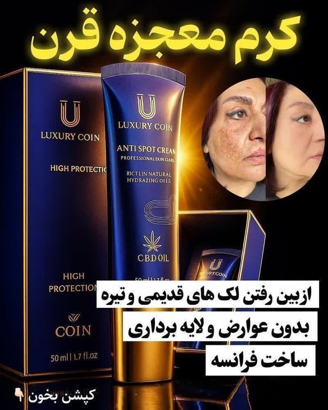 کرم بیوممتیک ضد لک لاکچری کوین اصل وارداتی